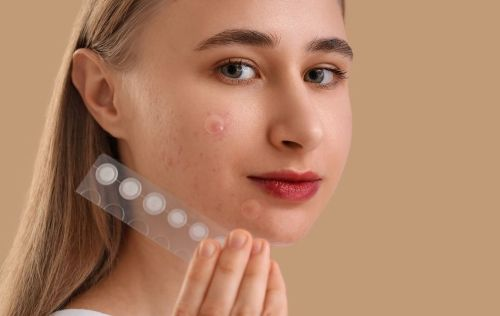 Pimple Patches: la tendencia de skincare que ayuda a cicatrizar los granitos y conquista las redes